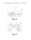 BLOOD VESSEL ACCESS SYSTEM AND DEVICE diagram and image