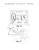 BLOOD VESSEL ACCESS SYSTEM AND DEVICE diagram and image