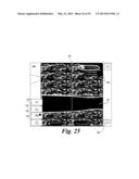 BLOOD VESSEL ACCESS SYSTEM AND DEVICE diagram and image