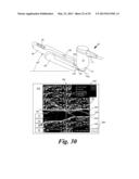 BLOOD VESSEL ACCESS SYSTEM AND DEVICE diagram and image