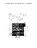 BLOOD VESSEL ACCESS SYSTEM AND DEVICE diagram and image