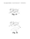 BLOOD VESSEL ACCESS SYSTEM AND DEVICE diagram and image