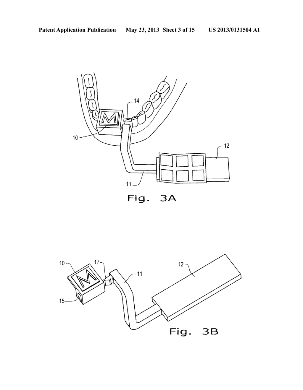 SOFT BODY AUTOMATIC REGISTRATION AND SURGICAL MONITORING SYSTEM - diagram, schematic, and image 04