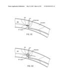 RECANALIZING OCCLUDED VESSELS USING RADIOFREQUENCY ENERGY diagram and image