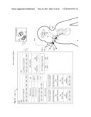 SYSTEMS, DEVICES, AND METHODS INCLUDING INFECTION-FIGHTING AND MONITORING     SHUNTS diagram and image