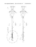 BALLOON CATHETER WITH EXTERNAL DELIVERY TUBE diagram and image