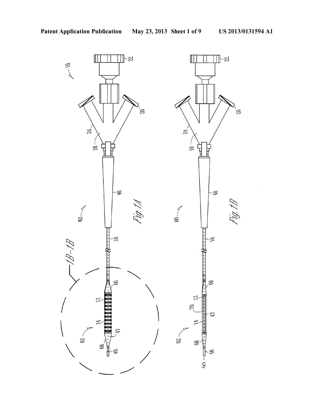 BALLOON CATHETER WITH EXTERNAL DELIVERY TUBE - diagram, schematic, and image 02