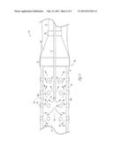 BALLOON CATHETER WITH EXTERNAL DELIVERY TUBE diagram and image