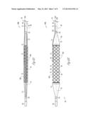 BALLOON CATHETER WITH EXTERNAL DELIVERY TUBE diagram and image