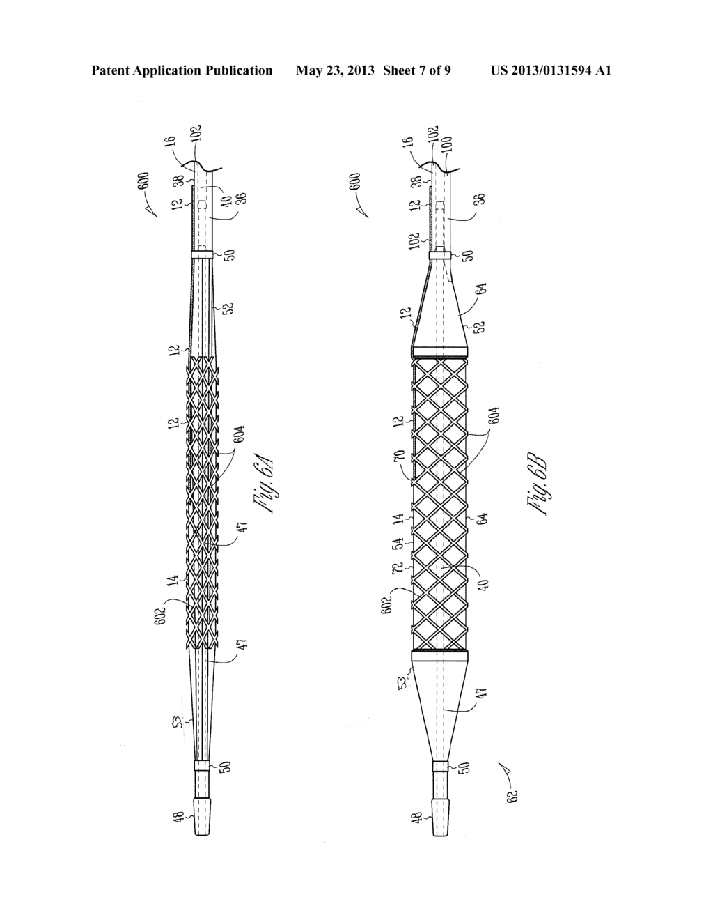 BALLOON CATHETER WITH EXTERNAL DELIVERY TUBE - diagram, schematic, and image 08