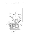 Treatment of Cellulite and Adipose Tissue with Mid-Infrared Radiation diagram and image