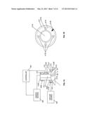 Eye Therapy System diagram and image