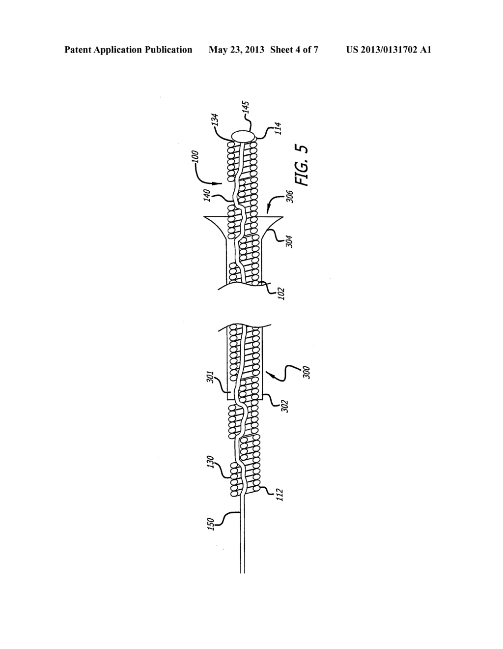 TETHERED COIL FOR TREATMENT OF BODY LUMENS - diagram, schematic, and image 05