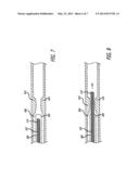 TETHERED COIL FOR TREATMENT OF BODY LUMENS diagram and image