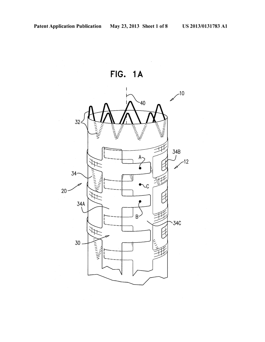 IMPLANTABLE MEDICAL DEVICES CONSTRUCTED OF SHAPE MEMORY MATERIAL - diagram, schematic, and image 02