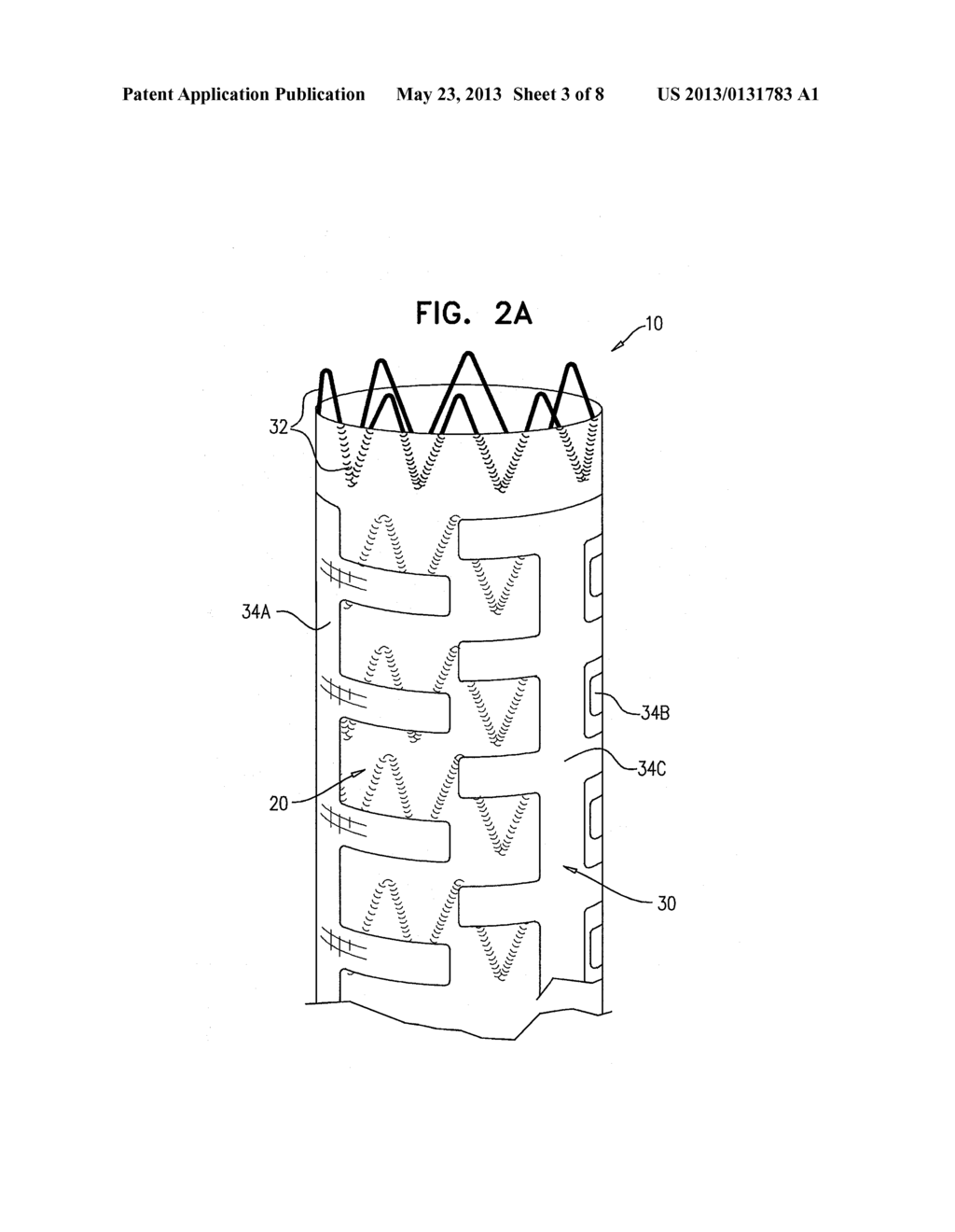 IMPLANTABLE MEDICAL DEVICES CONSTRUCTED OF SHAPE MEMORY MATERIAL - diagram, schematic, and image 04