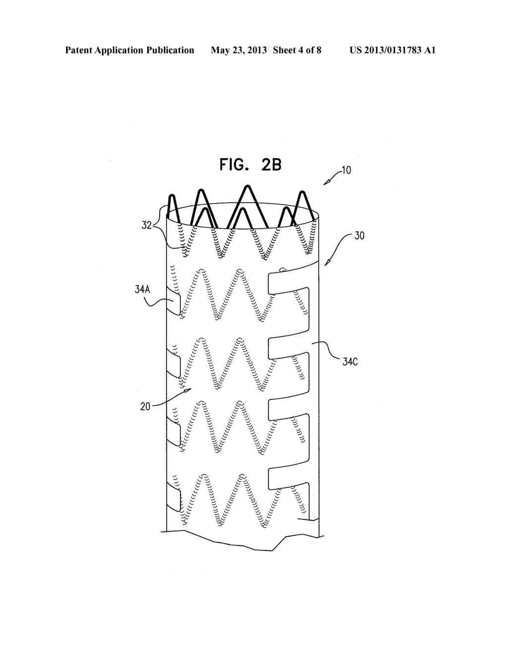 IMPLANTABLE MEDICAL DEVICES CONSTRUCTED OF SHAPE MEMORY MATERIAL - diagram, schematic, and image 05