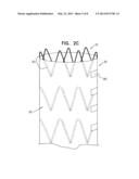 IMPLANTABLE MEDICAL DEVICES CONSTRUCTED OF SHAPE MEMORY MATERIAL diagram and image