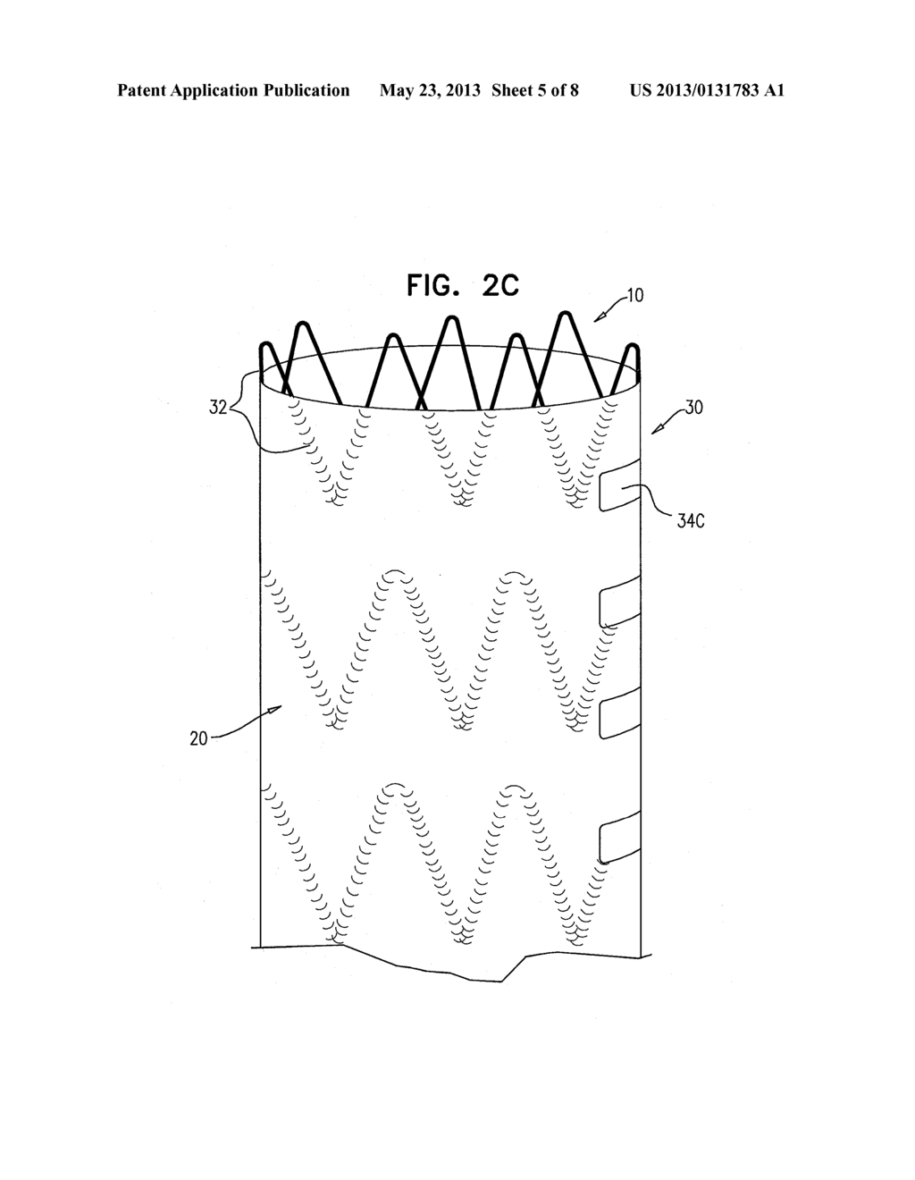 IMPLANTABLE MEDICAL DEVICES CONSTRUCTED OF SHAPE MEMORY MATERIAL - diagram, schematic, and image 06