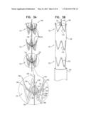 IMPLANTABLE MEDICAL DEVICES CONSTRUCTED OF SHAPE MEMORY MATERIAL diagram and image