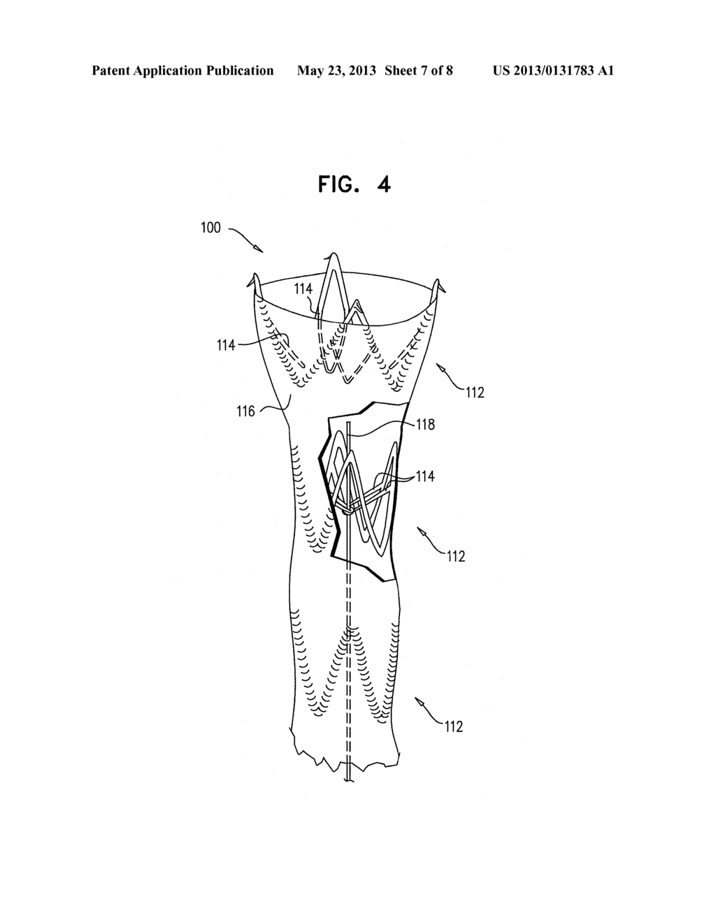 IMPLANTABLE MEDICAL DEVICES CONSTRUCTED OF SHAPE MEMORY MATERIAL - diagram, schematic, and image 08