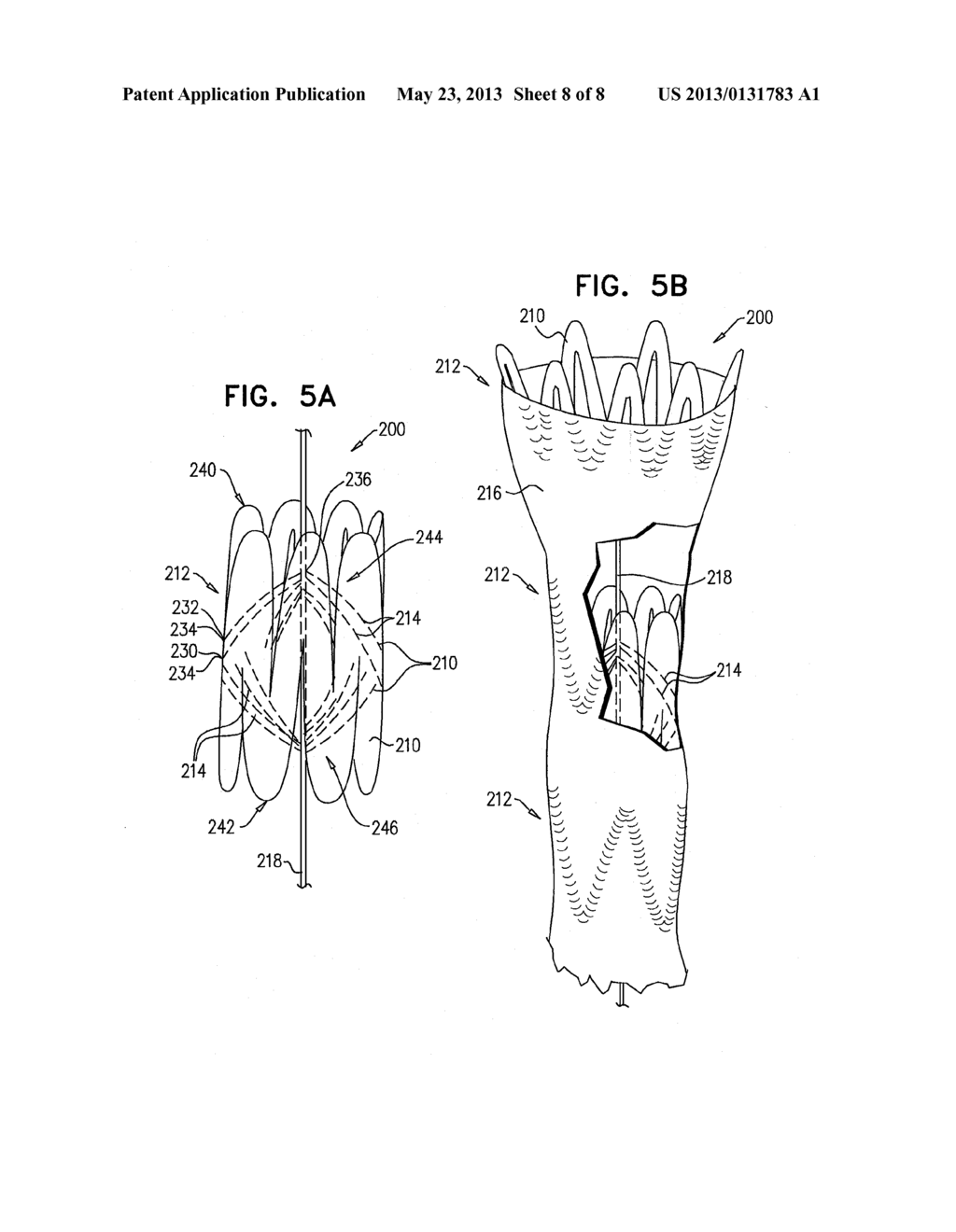 IMPLANTABLE MEDICAL DEVICES CONSTRUCTED OF SHAPE MEMORY MATERIAL - diagram, schematic, and image 09