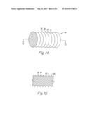 METALLIC IMPLANTABLE GRAFTS AND METHOD OF MAKING SAME diagram and image