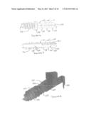 HAMMERTOE IMPLANT diagram and image