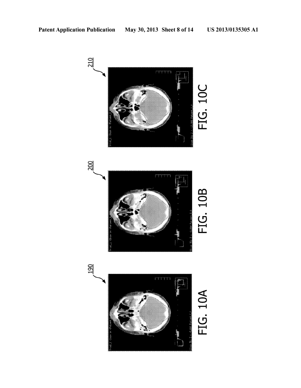 IN-PLANE AND INTERACTIVE SURFACE MESH ADAPTATION - diagram, schematic, and image 09