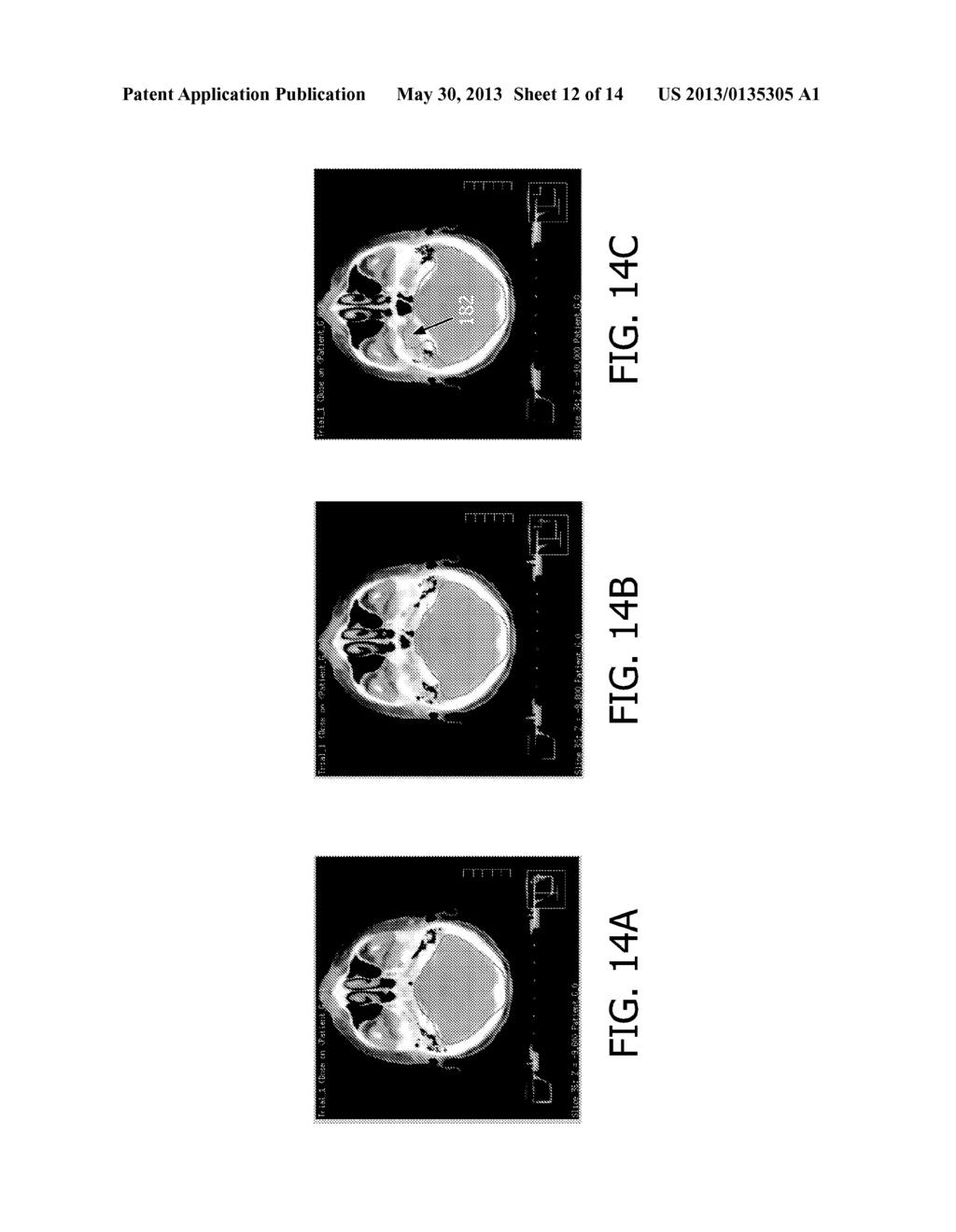 IN-PLANE AND INTERACTIVE SURFACE MESH ADAPTATION - diagram, schematic, and image 13