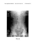 METHOD OF DETECTING FOREIGN BODIES diagram and image