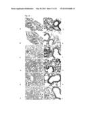 Nanoparticles for Targeted Delivery of Active Agents to the Lung diagram and image