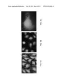 METALLIC NANOPARTICLES WITH COATED SHELLS AND APPLICATIONS OF SAME diagram and image