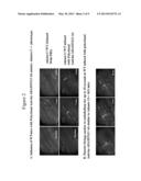 ADAMTS13-CONTAINING COMPOSITIONS HAVING THROMBOLYTIC ACTIVITY diagram and image