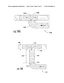 Apparatus And Method For Skinning Articles diagram and image