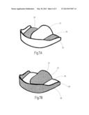 CARRIER FOR DENTAL IMPRESSION COMPOUND diagram and image