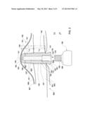 DENTAL IMPLANTS, DEVICES AND METHODS ASSOCIATED WITH DENTAL IMPLANTATION     PROCEDURES diagram and image