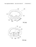 DENTAL IMPLANTS, DEVICES AND METHODS ASSOCIATED WITH DENTAL IMPLANTATION     PROCEDURES diagram and image