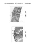 HUMAN GASTROINTESTINAL STEM CELL-DERIVED PRIMARY INTESTINAL EPITHELIAL     CELL SYSTEM AND METHODS OF USE THEREOF diagram and image