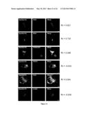 Diagnosis of Hereditary Spastic Paraplegias (HSP) by Identification of a     Mutation in the ZFVYE26 Gene or Protein diagram and image