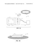 METHOD AND SYSTEM TO DISPLAY ANALYTE SENSOR DATA diagram and image