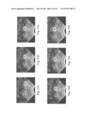 Devices, Systems, and Methods for Controlling Field of View in Imaging     Systems diagram and image