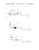 Intravascular Tissue Disruption diagram and image