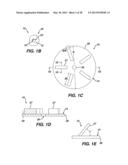 Arthroplasty Instruments and Associated Method diagram and image