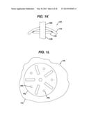 Arthroplasty Instruments and Associated Method diagram and image