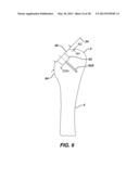 Arthroplasty Instruments and Associated Method diagram and image