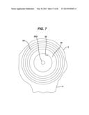 Arthroplasty Instruments and Associated Method diagram and image