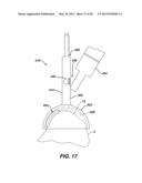 Arthroplasty Instruments and Associated Method diagram and image