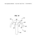 Arthroplasty Instruments and Associated Method diagram and image