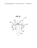 Arthroplasty Instruments and Associated Method diagram and image